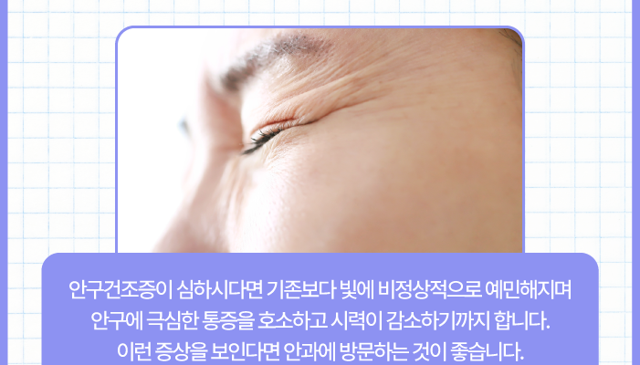 MGD explained — Goyang Shinsegae Eye Clinic, Ilsan