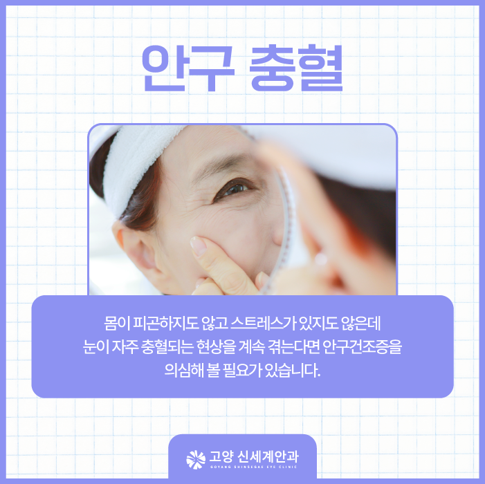 Dry eye explained — Goyang Shinsegae Eye Clinic, Ilsan