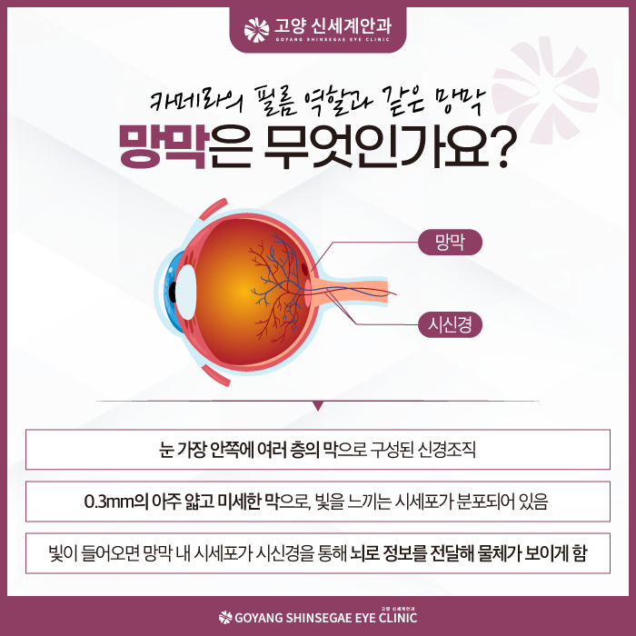 retinal detachment explained — Goyang Shinsegae Eye Clinic, Ilsan